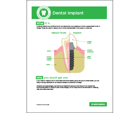DDAZ_CommonProcedures_Implant.png