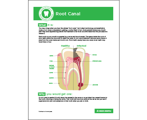 DDAZ_CommonProcedures_RootCanal.png