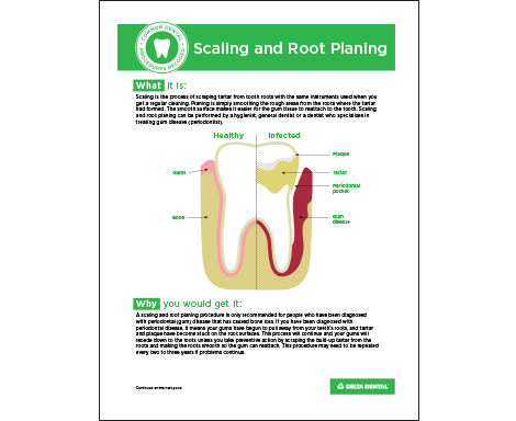 DDAZ_CommonProcedures_Scaling-Planing.png