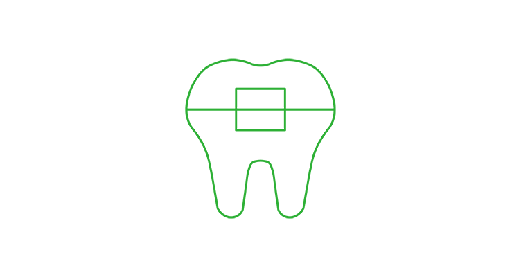 braces-icon-752x400.png